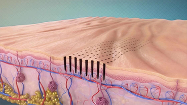 비너스비바 피부