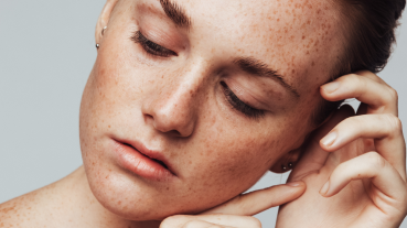 SMAS층 리프팅 지방세포 사멸